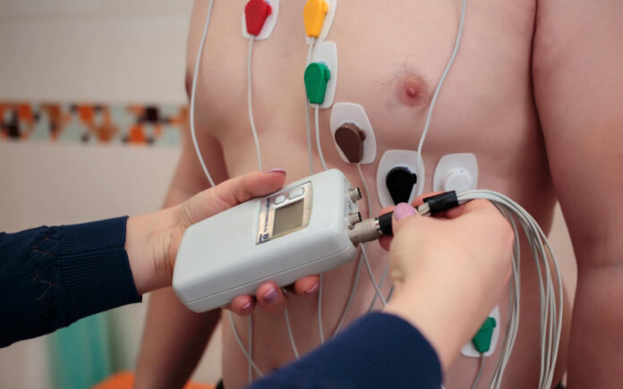 Holter monitor test Sydney