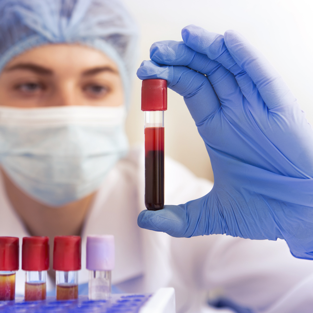 blood analysis Melbourne